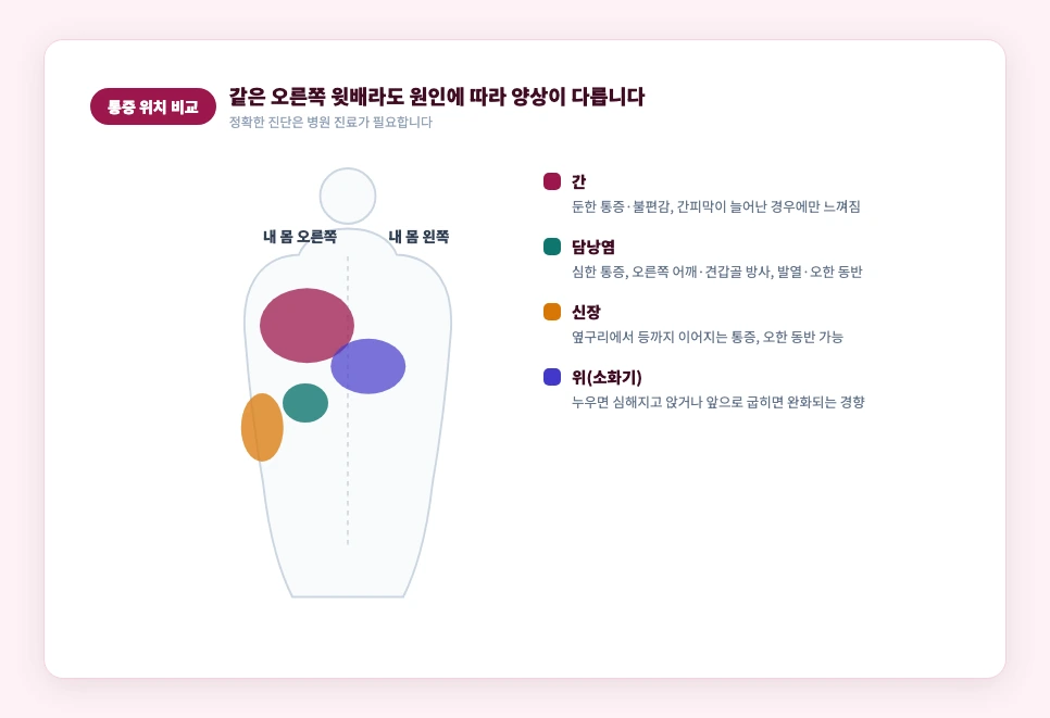 간·담낭·신장·위 통증 위치 비교