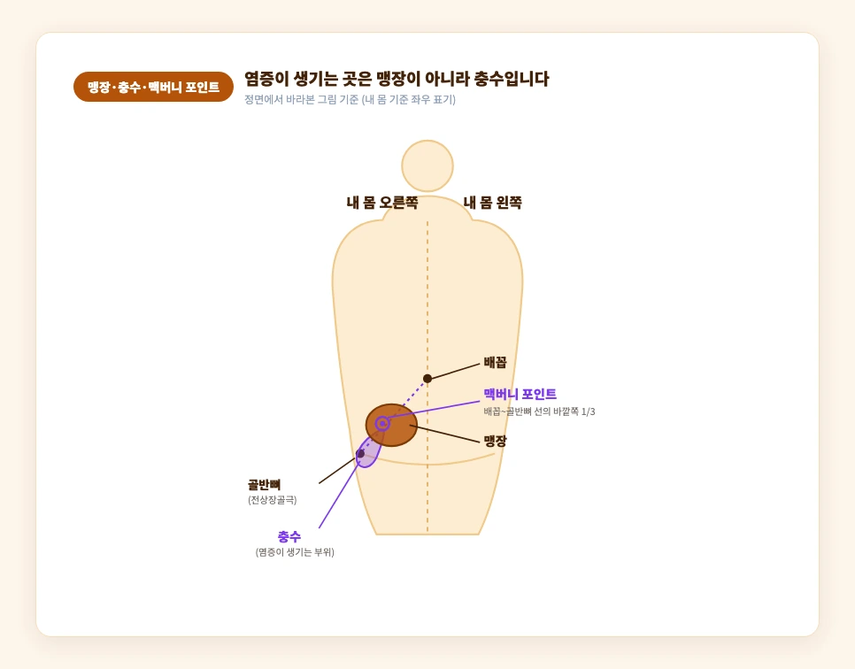 맹장·충수·맥버니 포인트의 정확한 위치